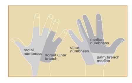 numbness in fingers